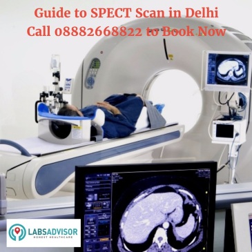 SPECT Scan Test Cost in Delhi