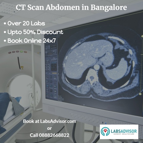 Book CT Abdomen in Bangalore Online