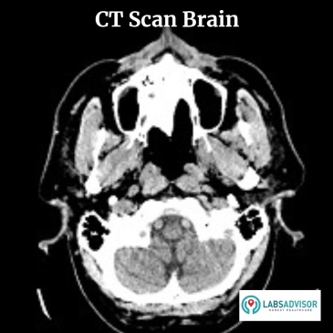 CT Scan Brain in Delhi