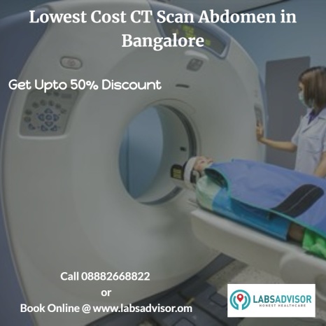 50% discount on CT Abdomen in Bangalore
